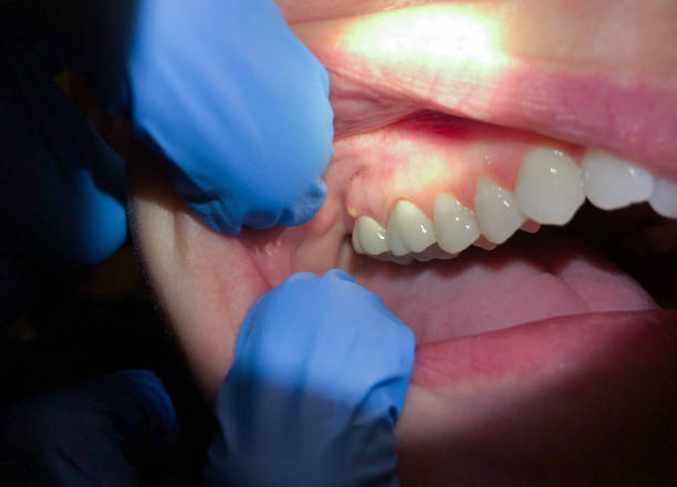 Emergency Dentist for Kids in SC