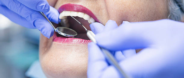 Best Emergency Dental Filling Replacement  in Wedgefield, SC